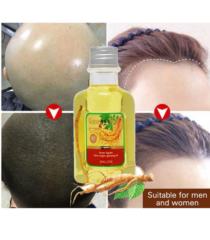 Buy Now Ginseng Root Hair Oil Anti Hair Fall and for Strong Hair Only